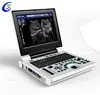 Portable Laptop Ultrasound